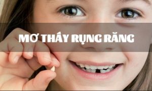 Mơ thấy rụng răng, giải mã giấc mơ rụng răng điềm gì?